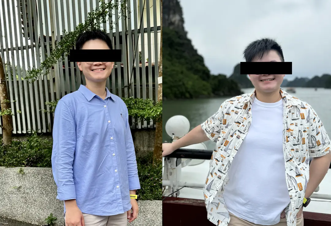 V 小姐前後對比